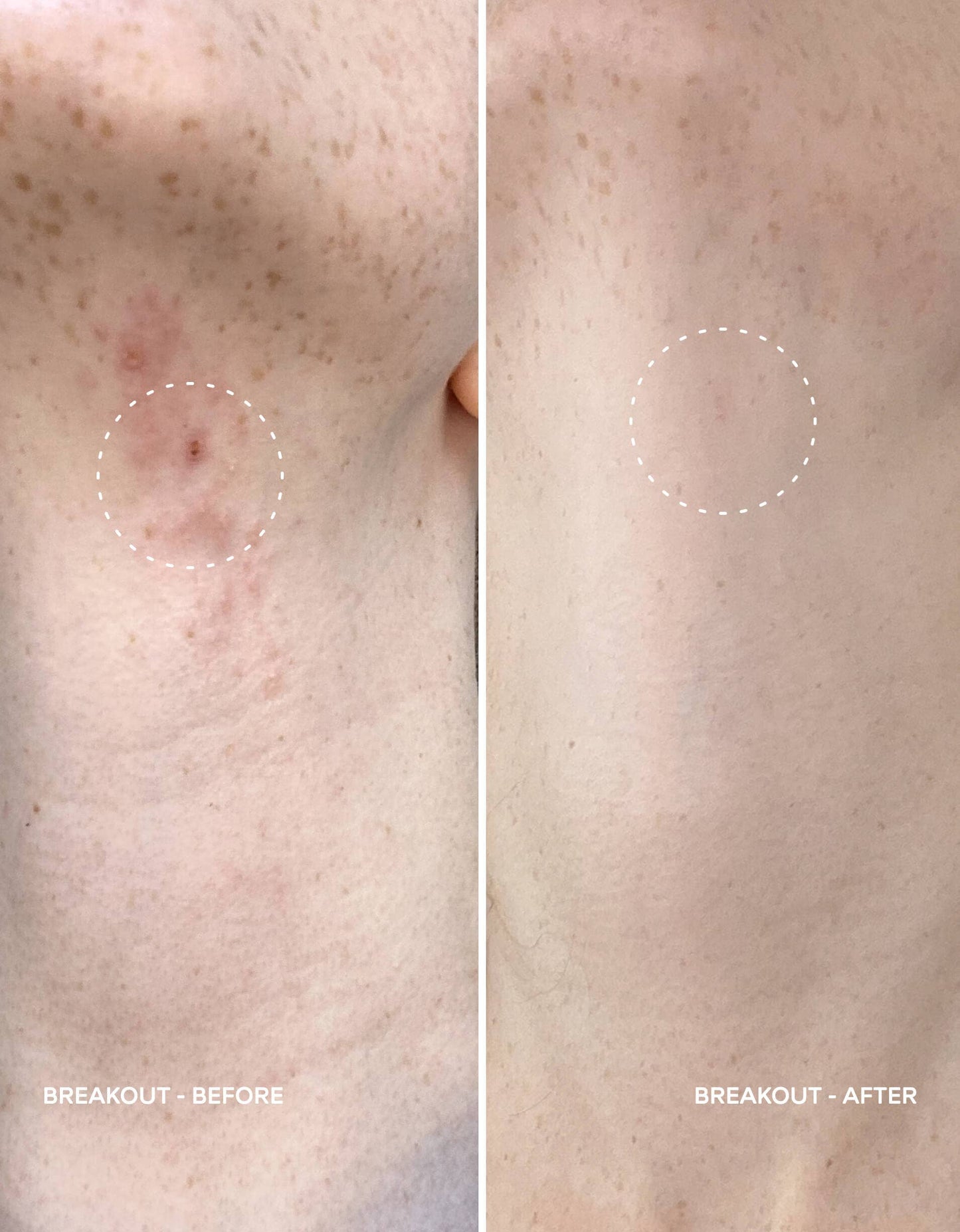 Magic Molecule Skin Spray