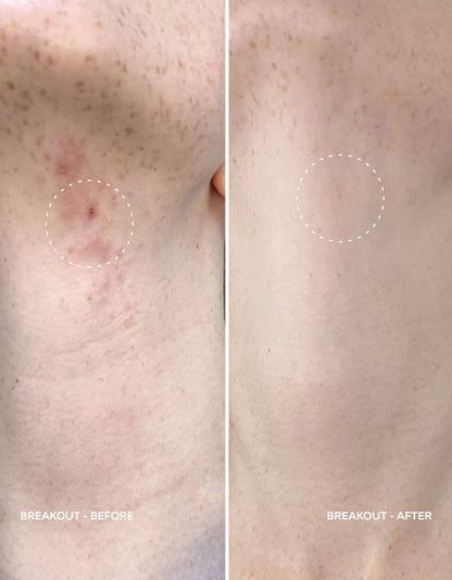 Magic Molecule Skin Spray